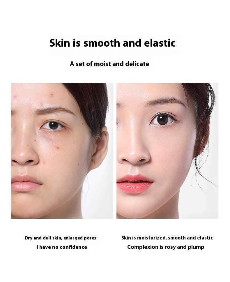Mei Dailin Anastatica Shurun Essence Moisturizing Refreshing Non-greasy Five-dimensional C Water And Lotion Set Wholesale